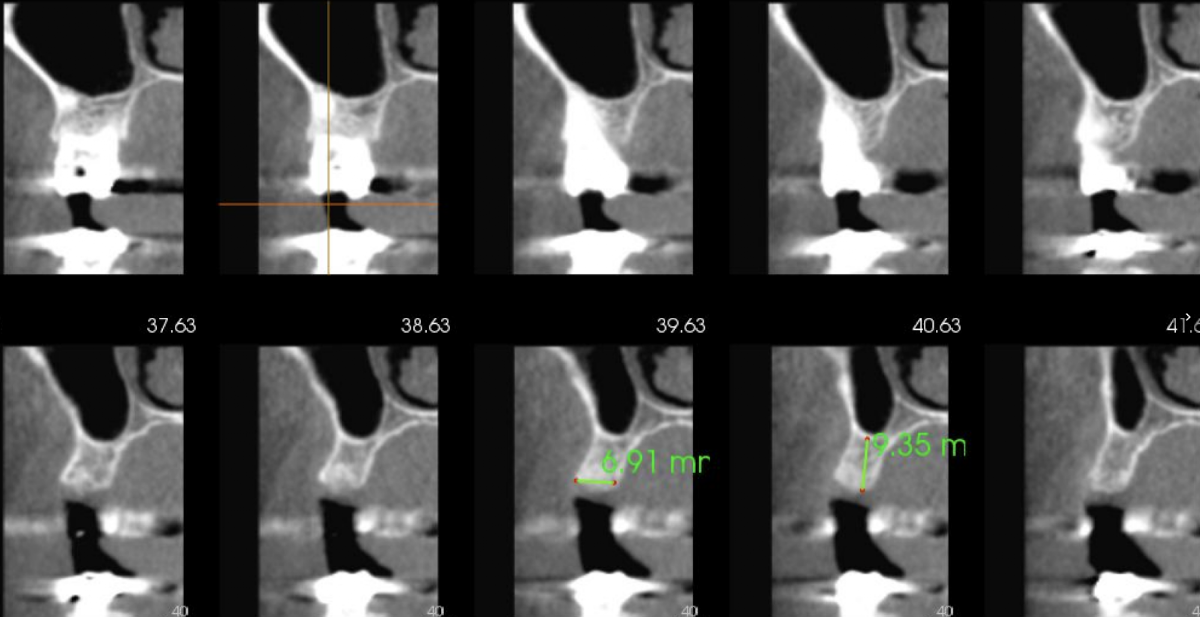 Stahr Oral Surgery photo 5
