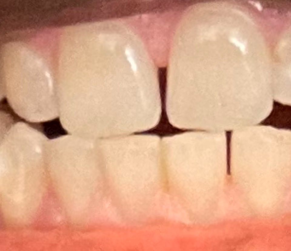 Aspen Dental - Conyers photo 6