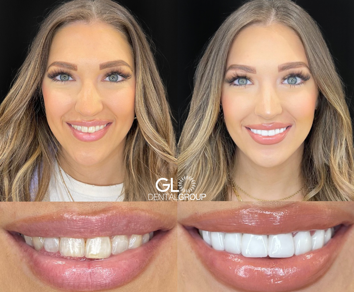 Glo Dental Group photo 2