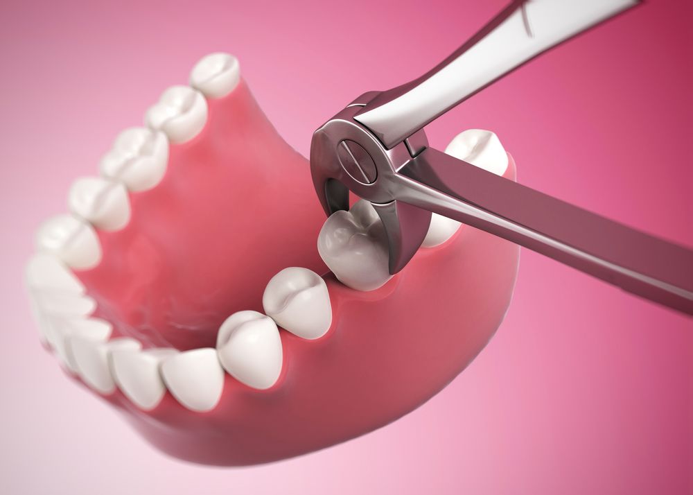Sunrise Dental Yakima photo 1