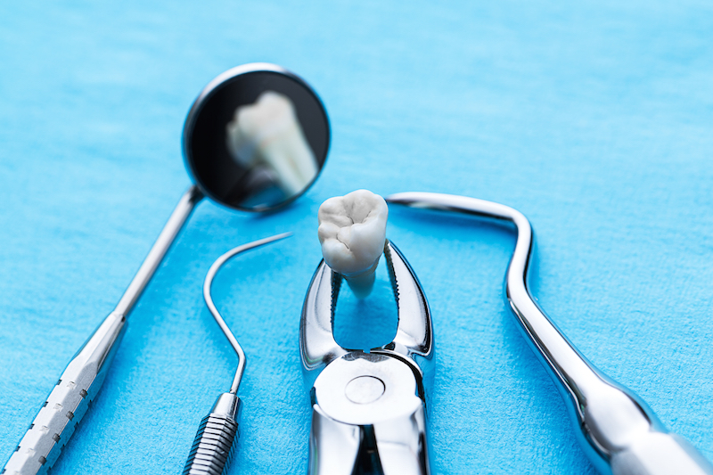 Sunrise Dental Yakima photo 5
