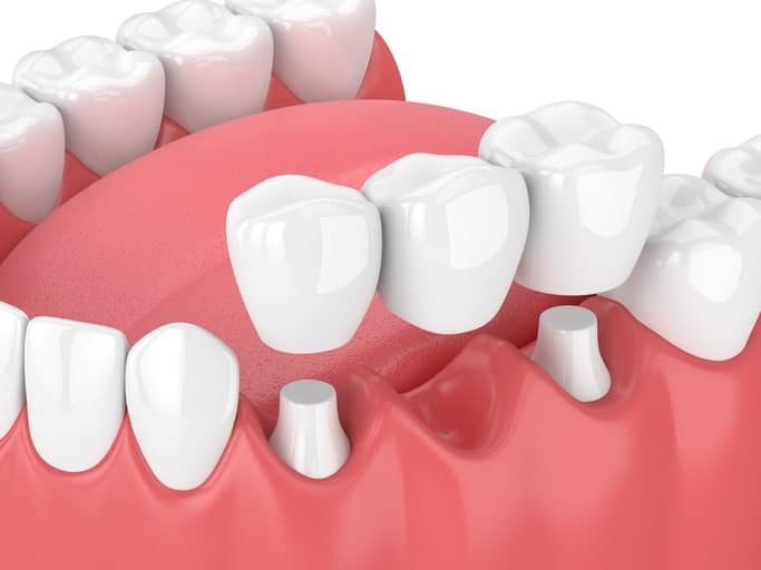 Sunrise Dental Yakima photo 6
