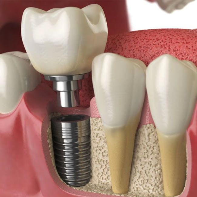 Golden Triangle Periodontal Center photo 3