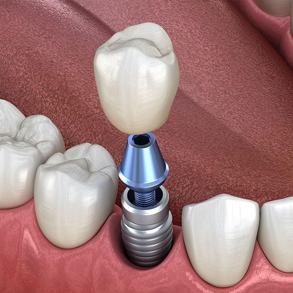 Golden Triangle Periodontal Center photo 4