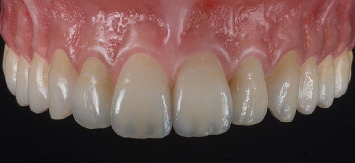 Pro-Craft Dental Laboratory, Inc photo 1