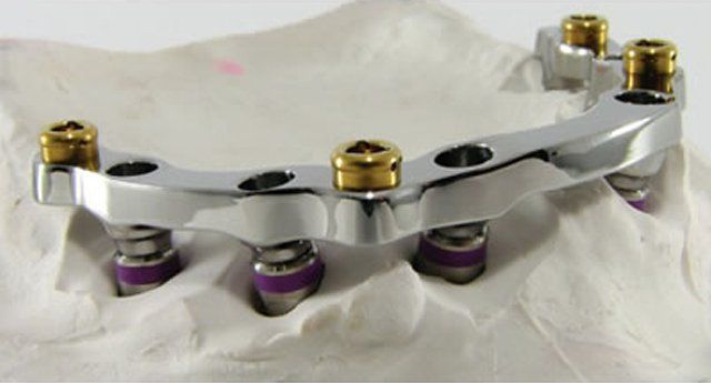 Pro-Craft Dental Laboratory, Inc photo 2