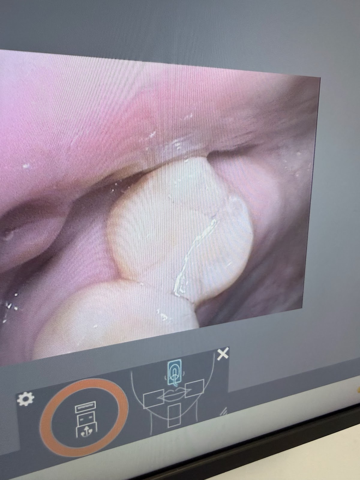 Knob Noster Family Dental photo 5