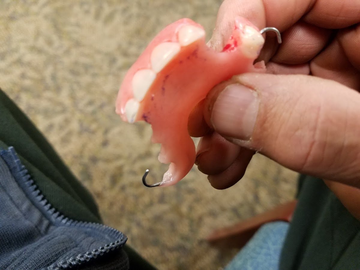Aspen Dental - Rutland photo 3