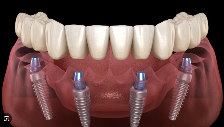 Oakley Oral Surgery - Dr. Richard M. Oakley photo 3