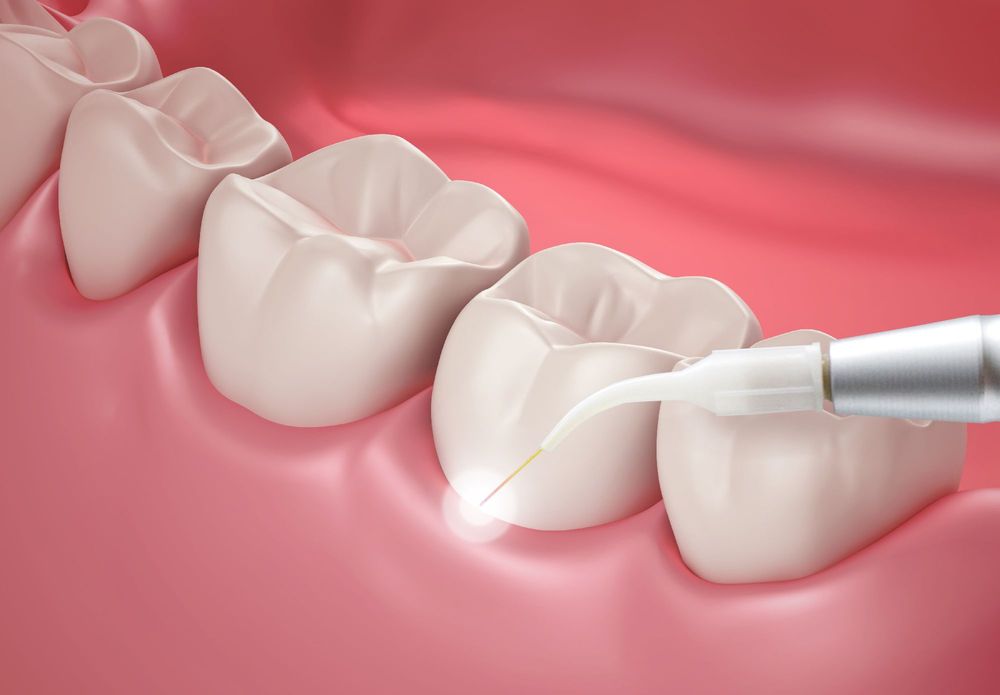 Implant and Family Dentistry: Timothy J. Hacker, DDS photo 3