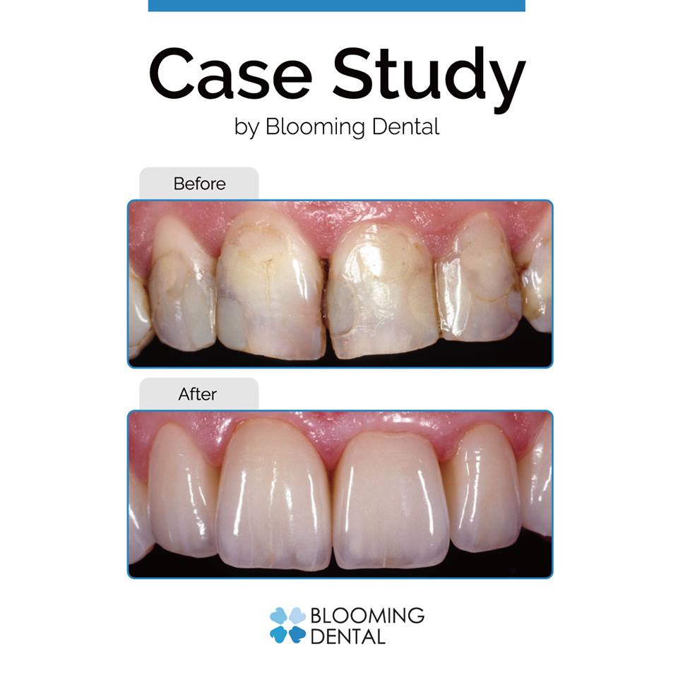 Blooming Dental - Implant & Prosthodontics photo 4