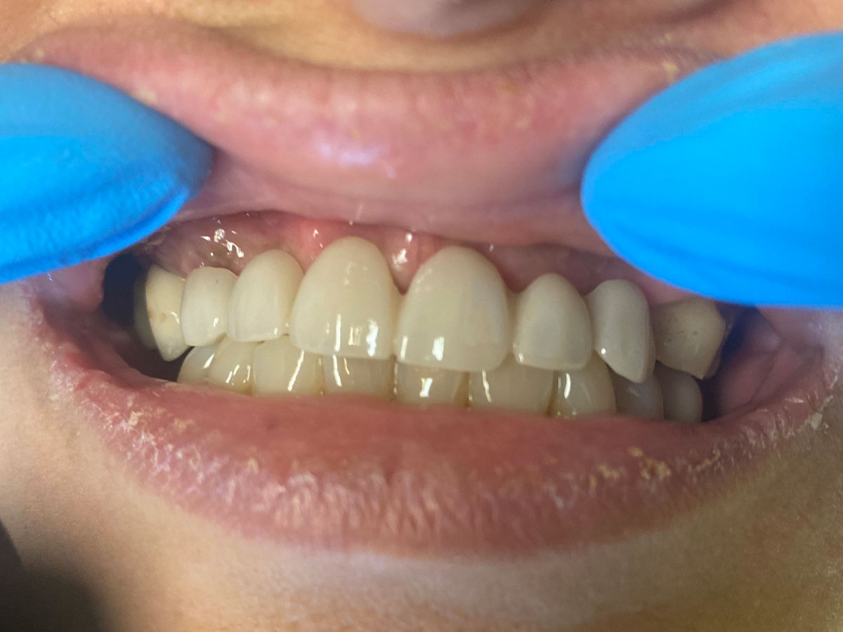 Mini Dental Implant Centers of America - Colorado Springs, Co photo 5