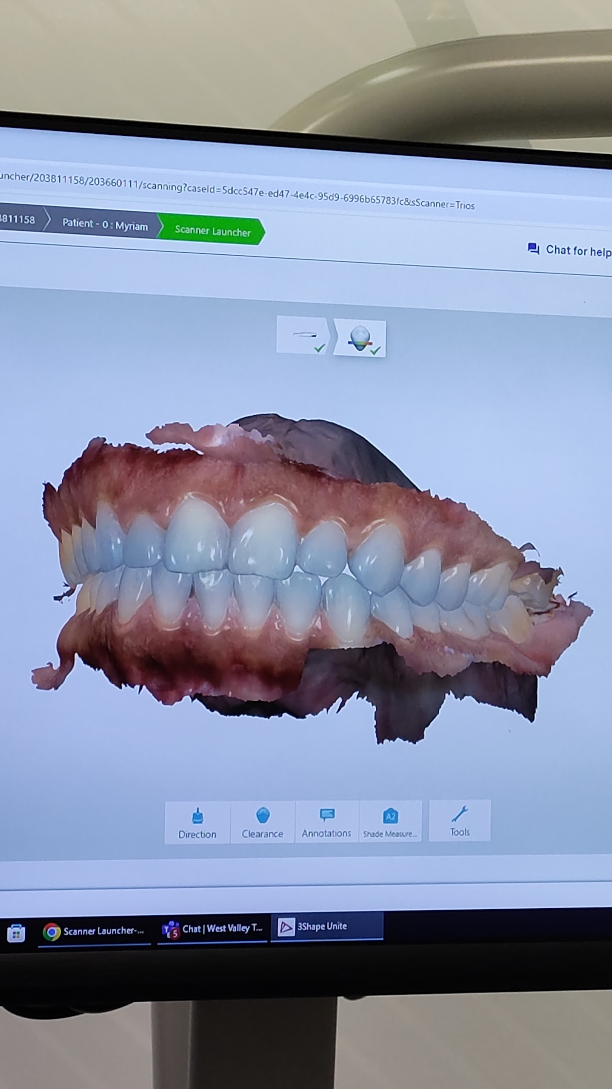 Aspen Dental - West Valley City photo 3