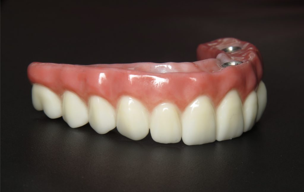 Bismarck Advanced Dental and Implants photo 3