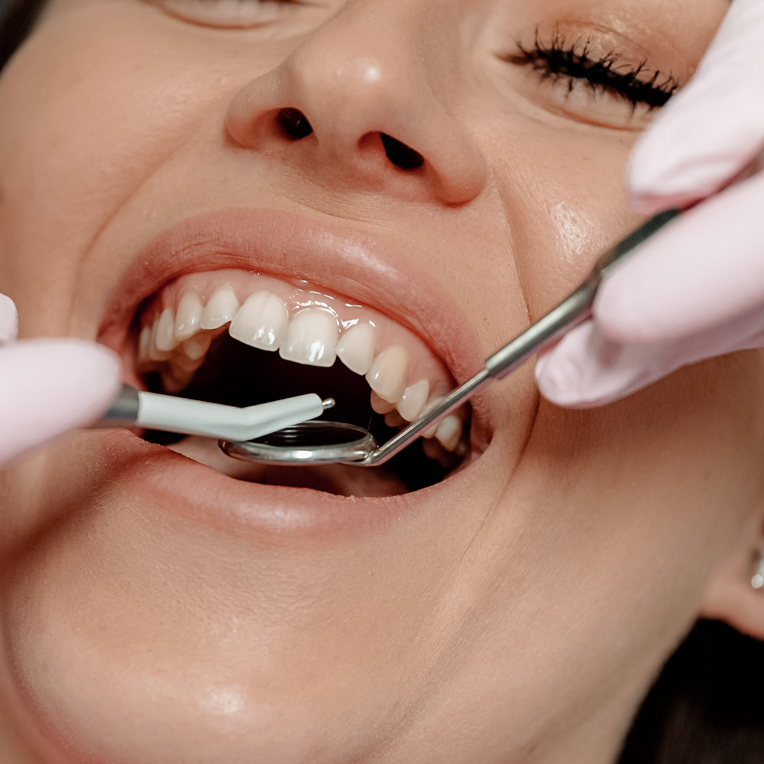 Fort Myers Laser Dentistry photo 4