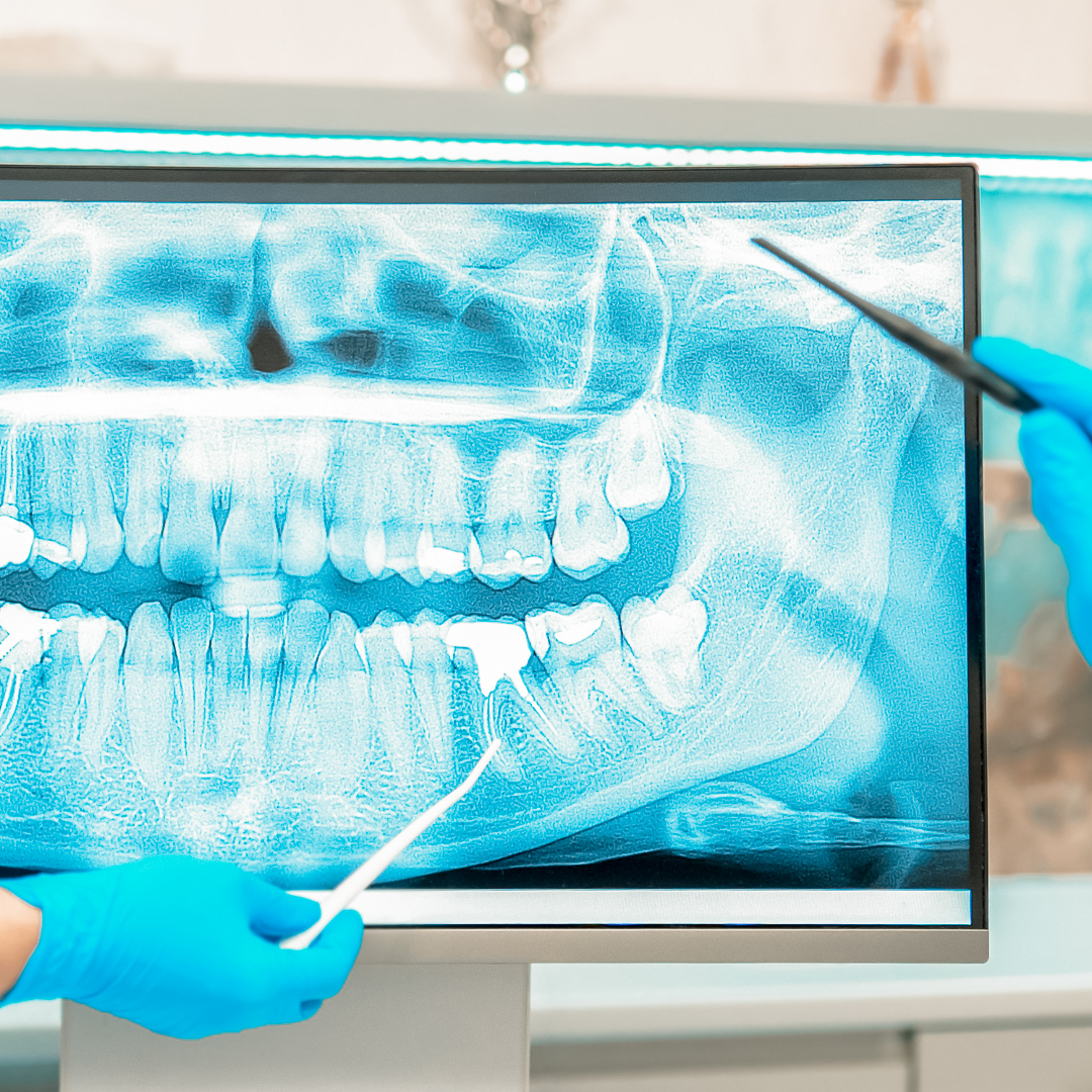 Fort Myers Laser Dentistry photo 6