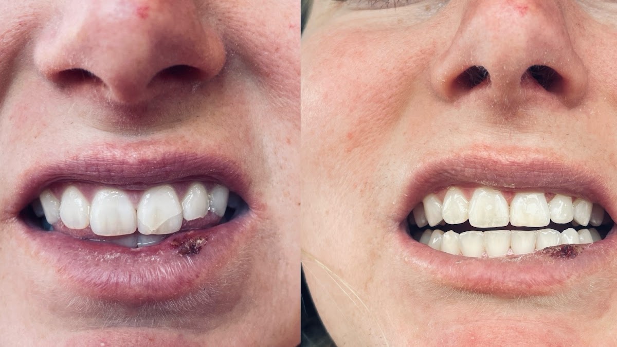 Colorado Smiles - Dr Amiee Rawlings photo 6