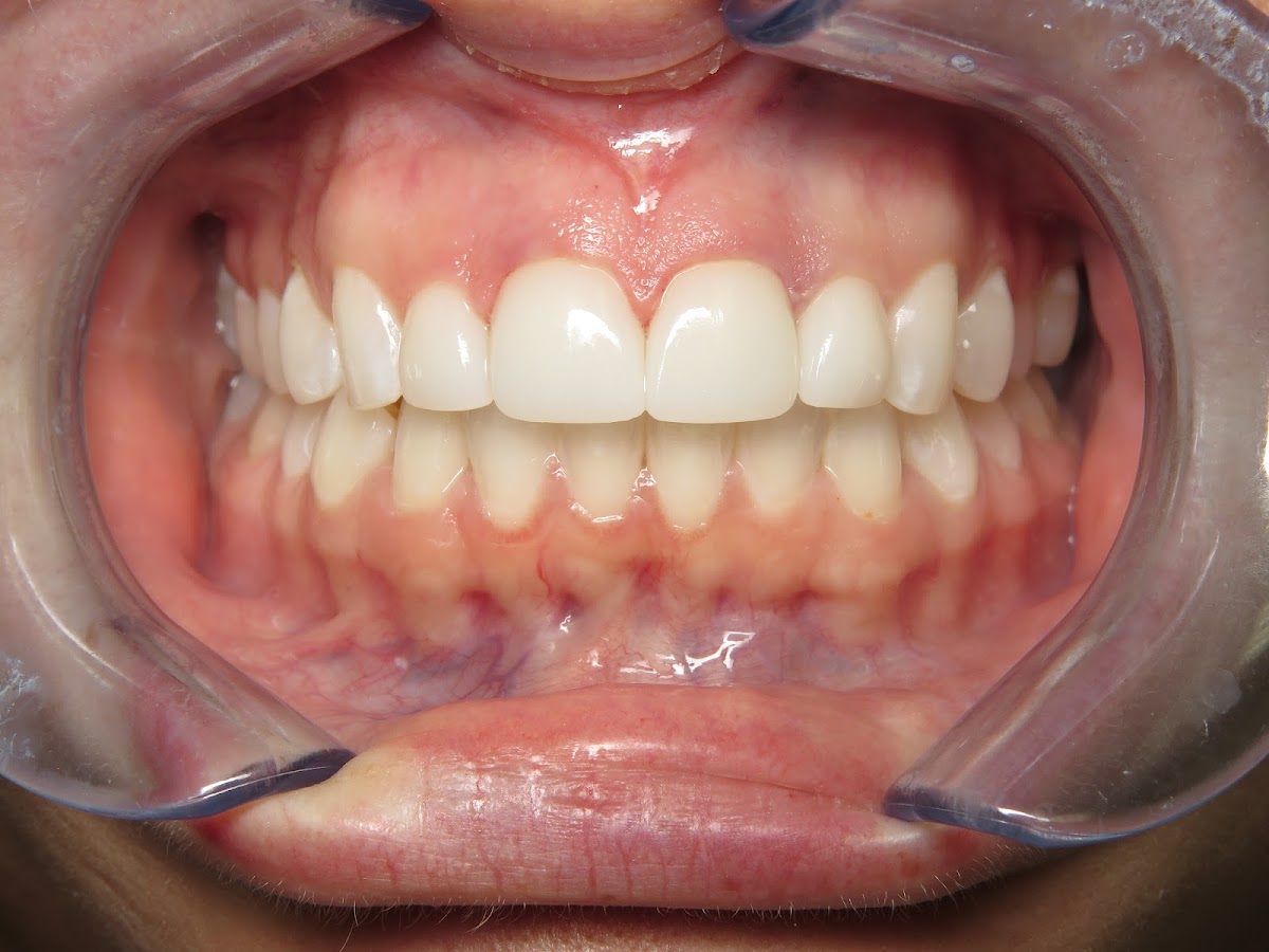 Michael C. Cordora, DDS, Agd Fellow photo 2