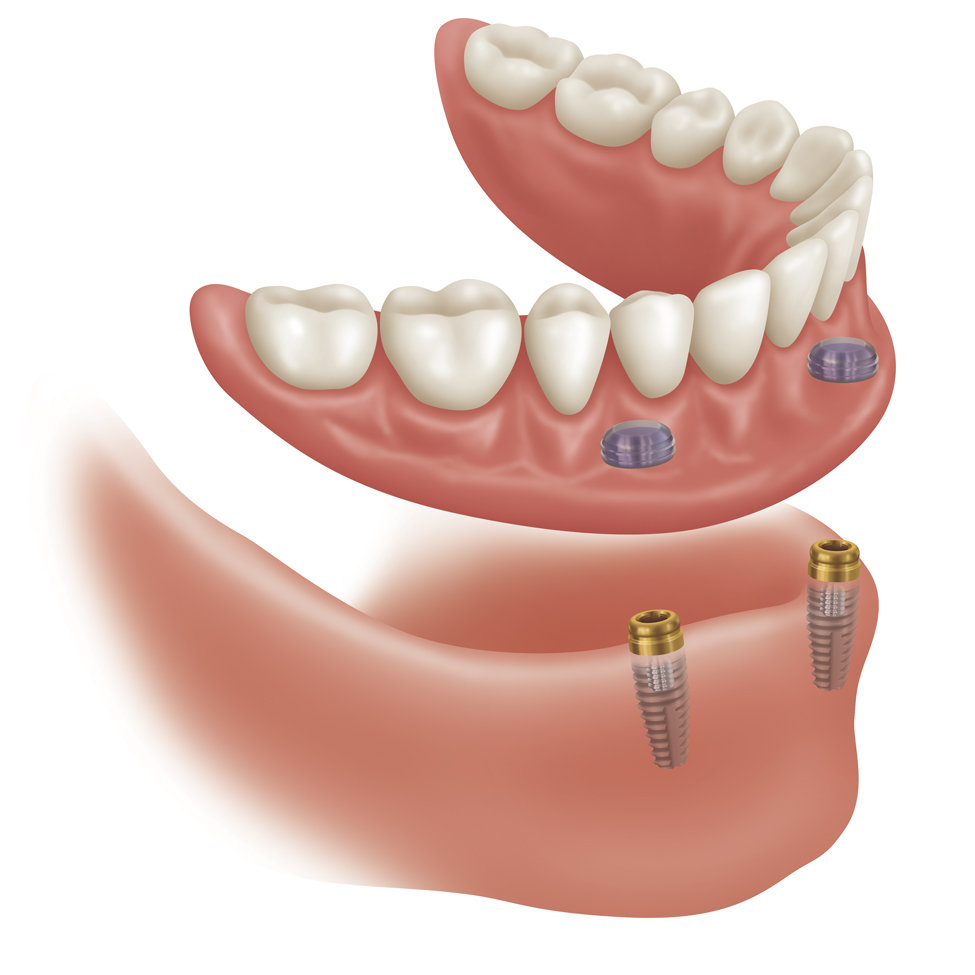 DDS Dentures & Implant Solutions of Tupelo photo 6