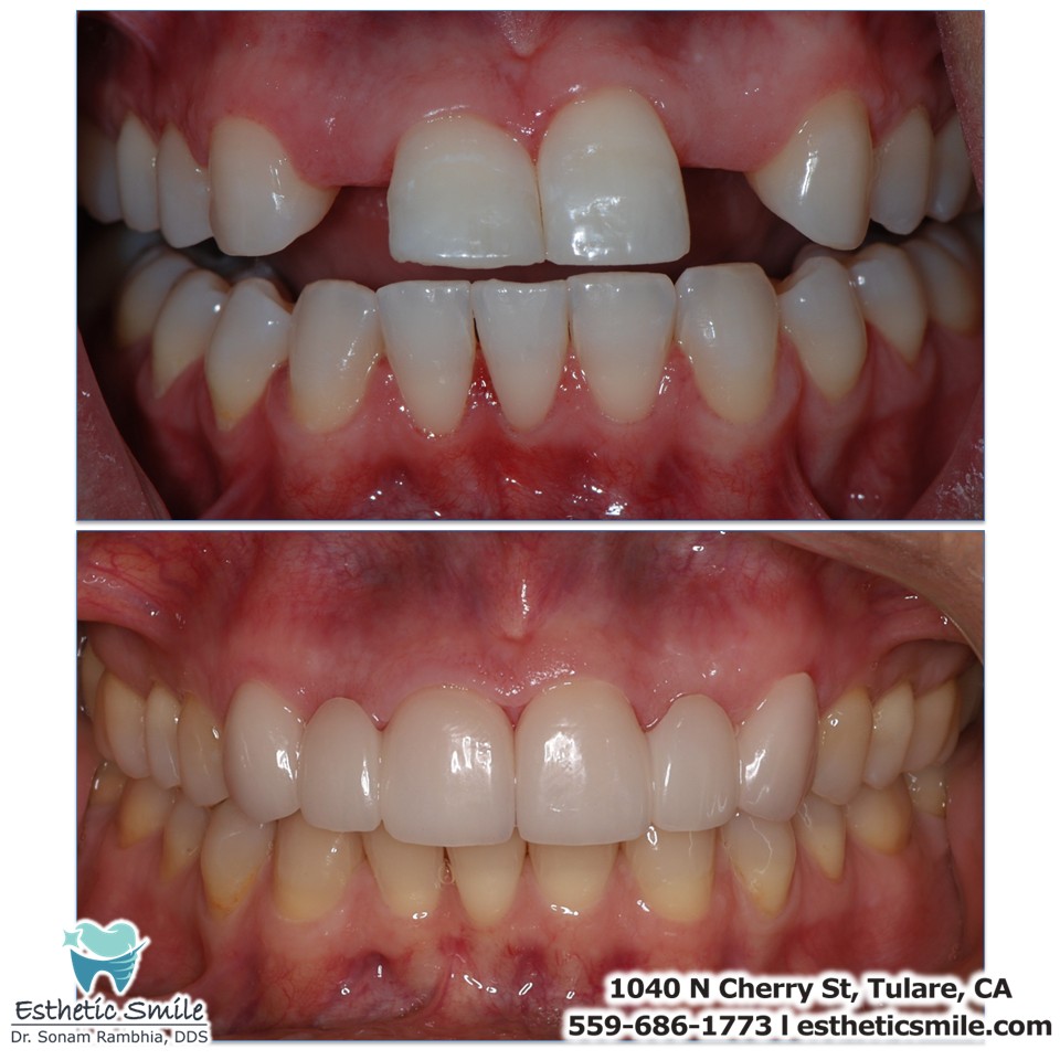 Dr Sonam Rambhia, Dds photo 6