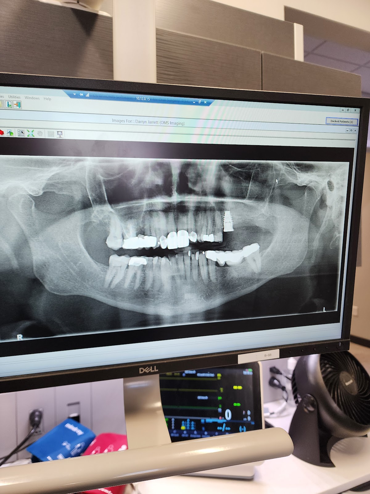 Kentucky Center for Oral and Maxillofacial Surgery photo 3