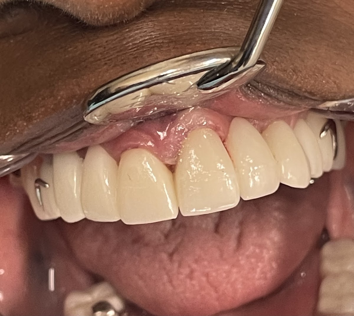 All Dental photo 4