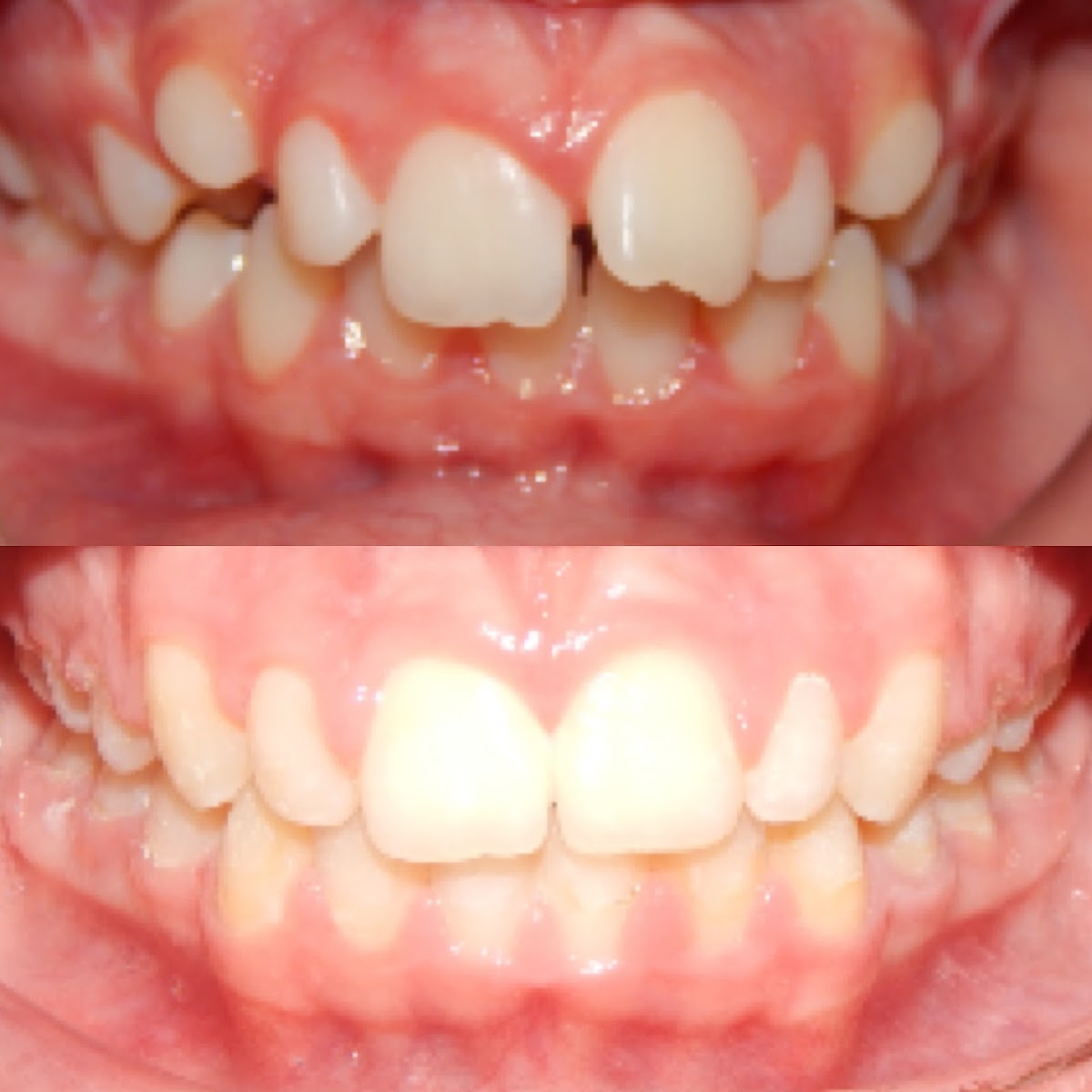 Toothworks of Bakersfield, Dentist and Orthodontist photo 6