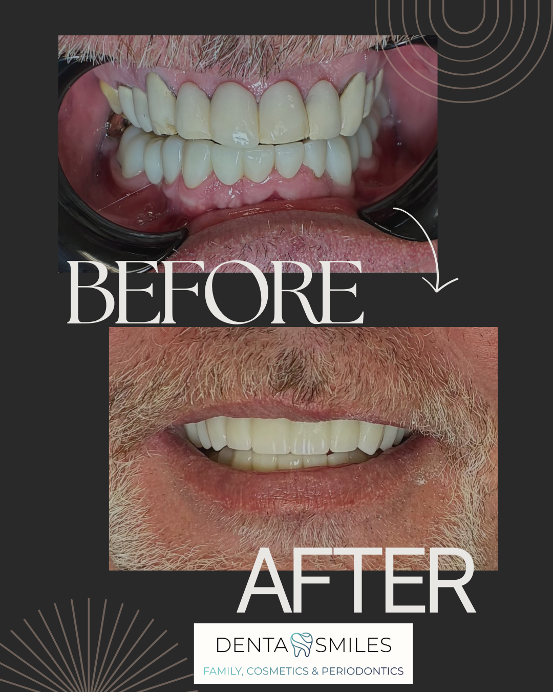 Denta Smiles Dental & Periodontics Coral Springs photo 2