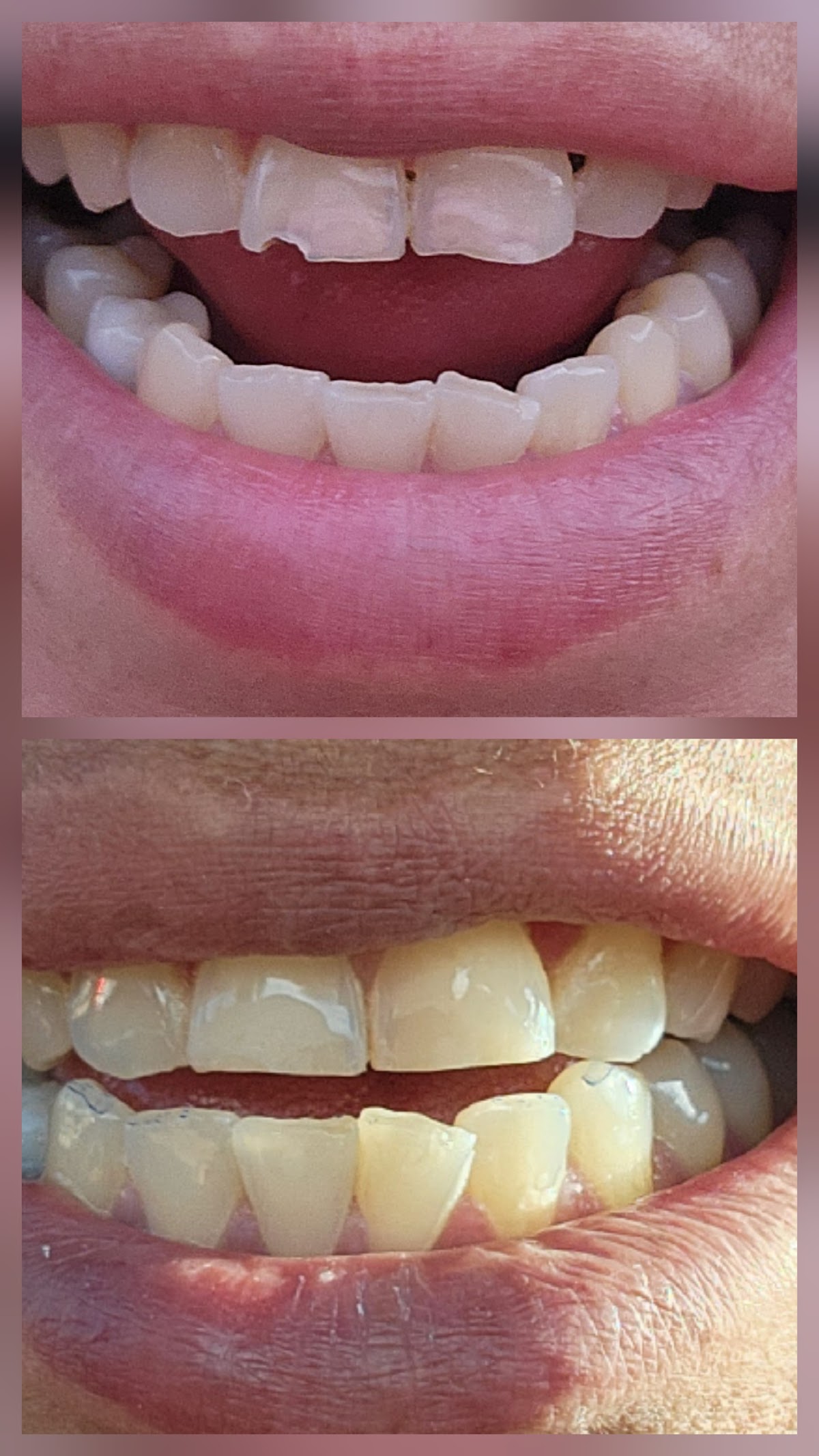 Aspen Dental - Surprise photo 4