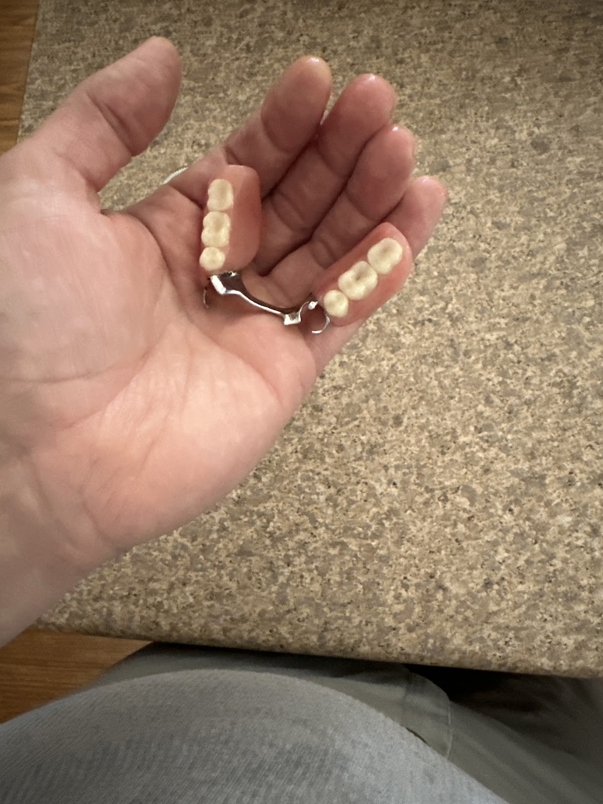 Aspen Dental - Surprise photo 6