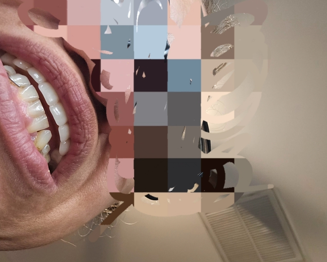 Affordable Dentures & Implants - Philadelphia photo 6