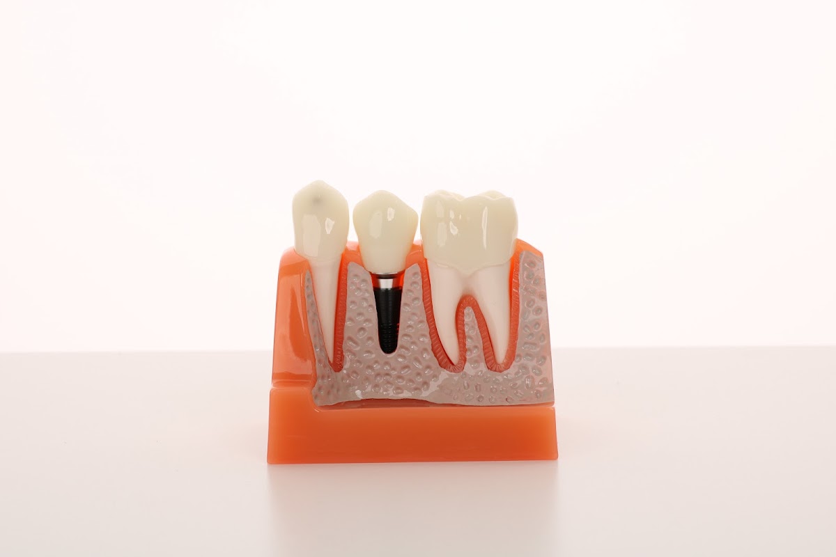Louisiana Implants and Dentures photo 6