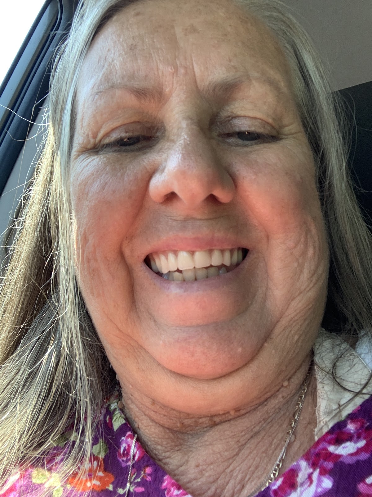 Affordable Dentures & Implants - St. Clairsville photo 5