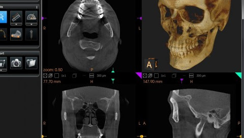 Tennessee Oral and Maxillofacial Surgeons photo 6