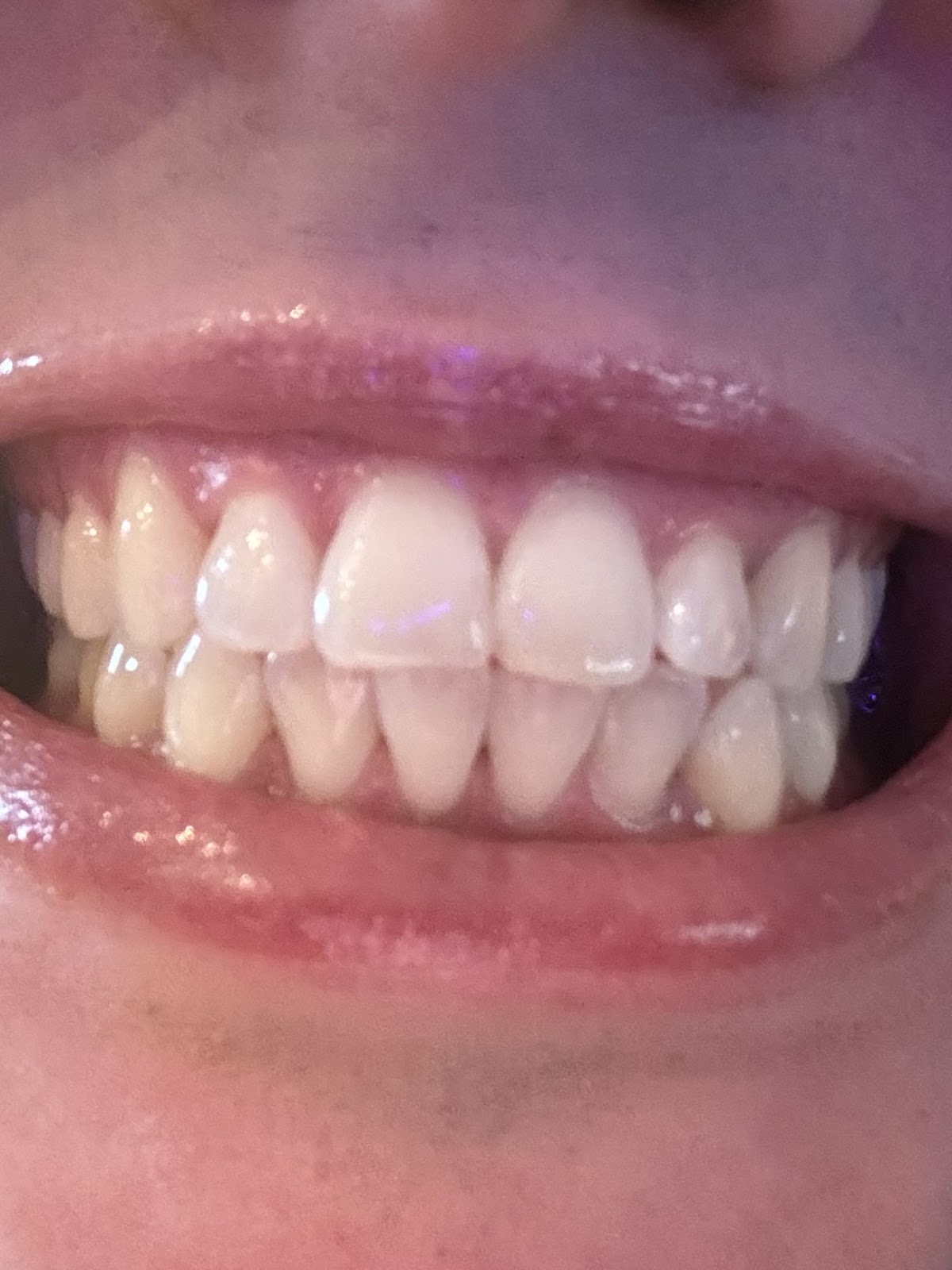 Aspen Dental - Conway photo 3