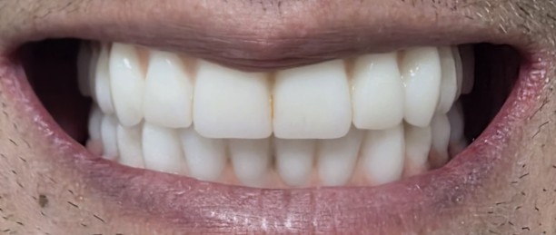 Smile Again Dental Implant Center - Greenville photo 1