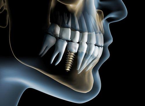 Metro West Dental & Implant Institute photo 1