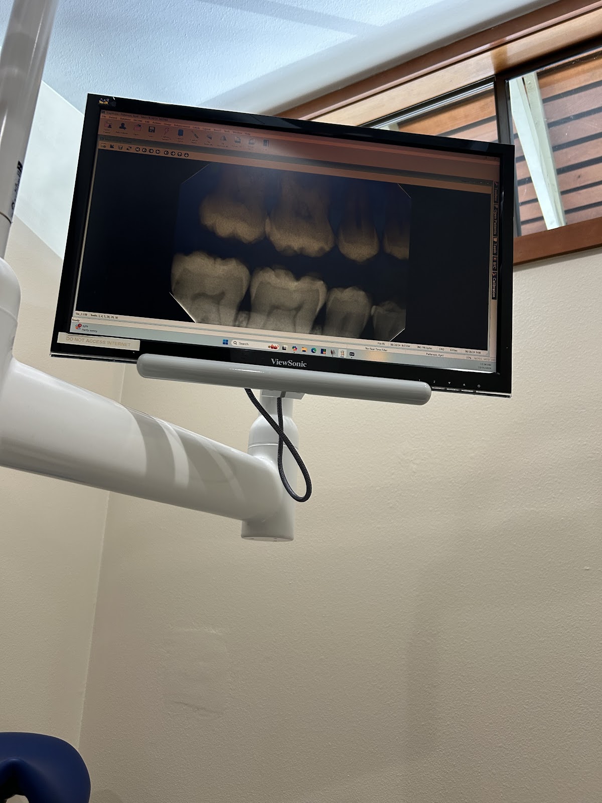 Alpine Dental photo 4
