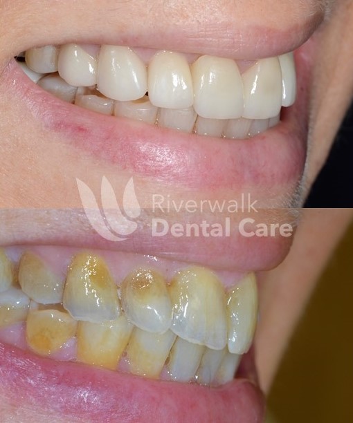 Riverwalk Dental Care photo 4