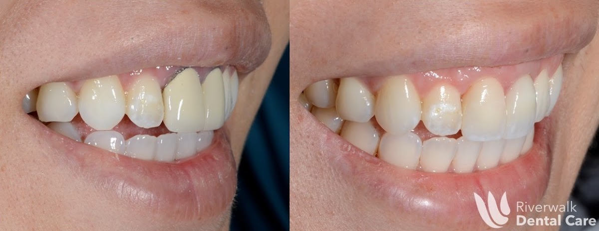 Riverwalk Dental Care photo 6