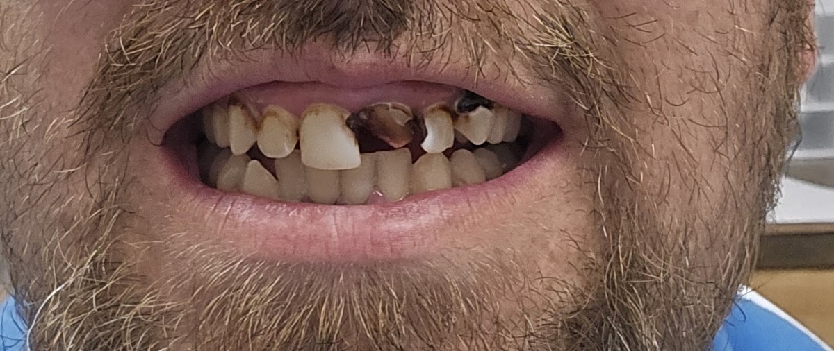 West Plains Family Dentistry photo 2