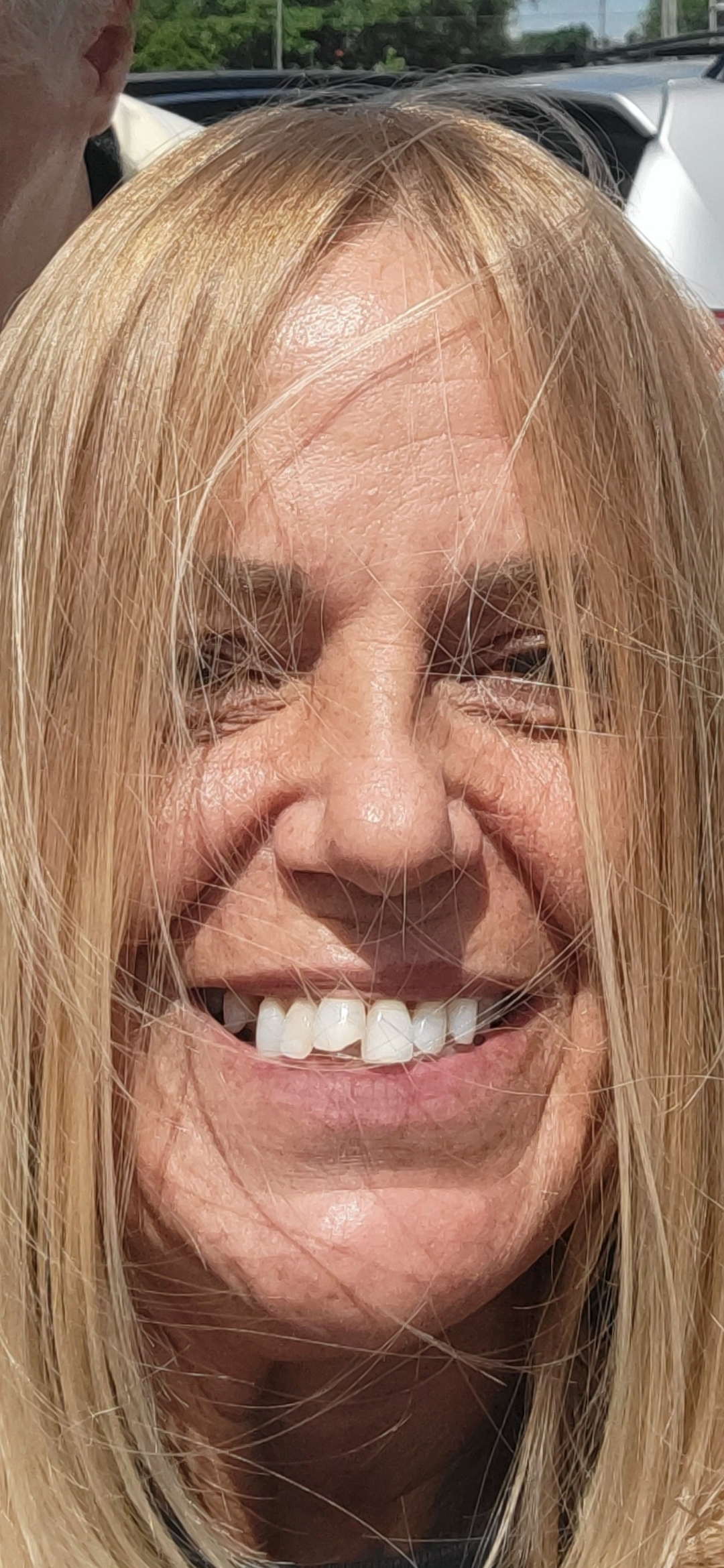 Affordable Dentures & Implants - Decatur photo 5