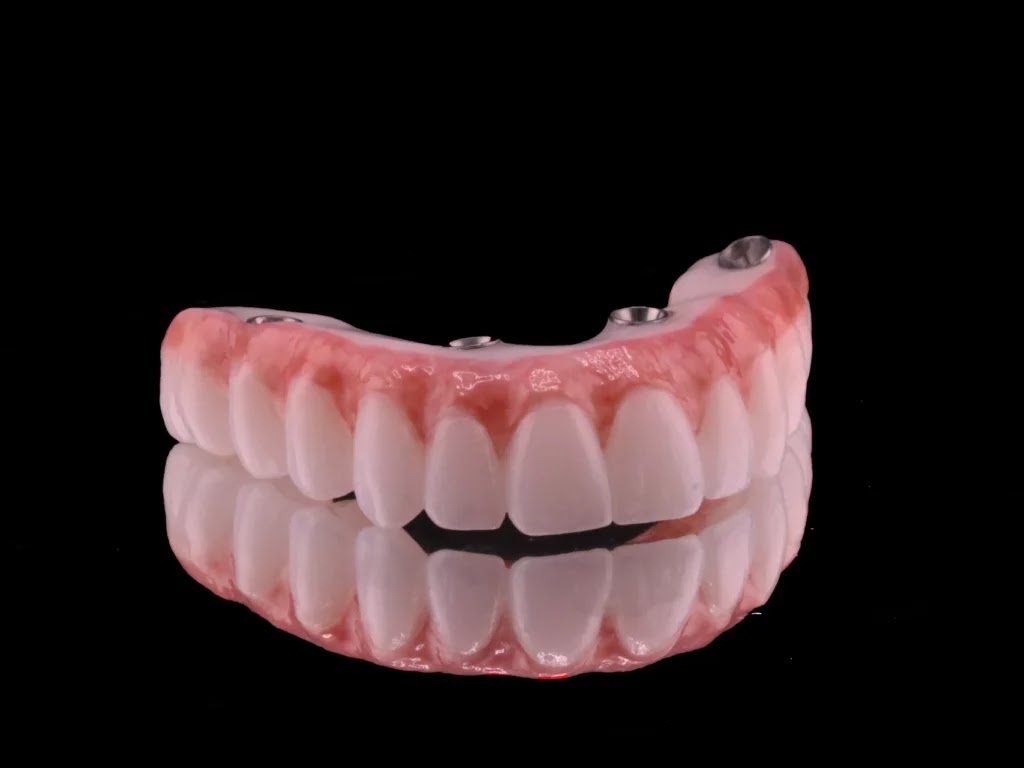 All on Smile Implant & Cosmetic Dentistry photo 3