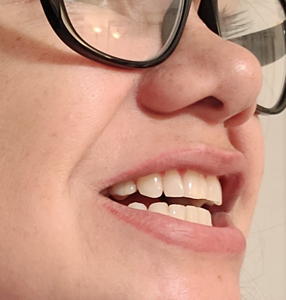 Implant Dentistry Periodontics & Facial Rejuvenation photo 5