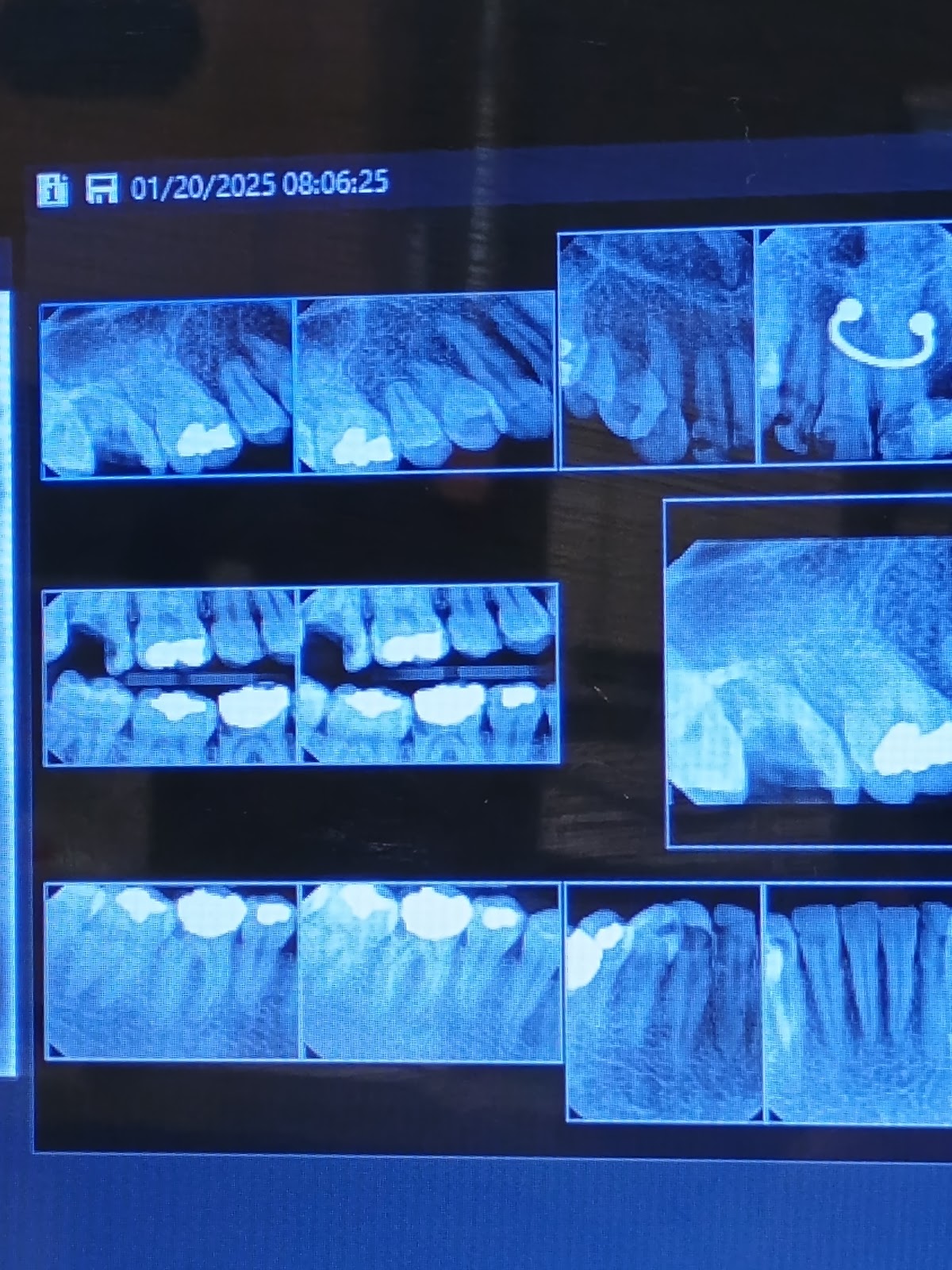 Aspen Dental - Joplin photo 4