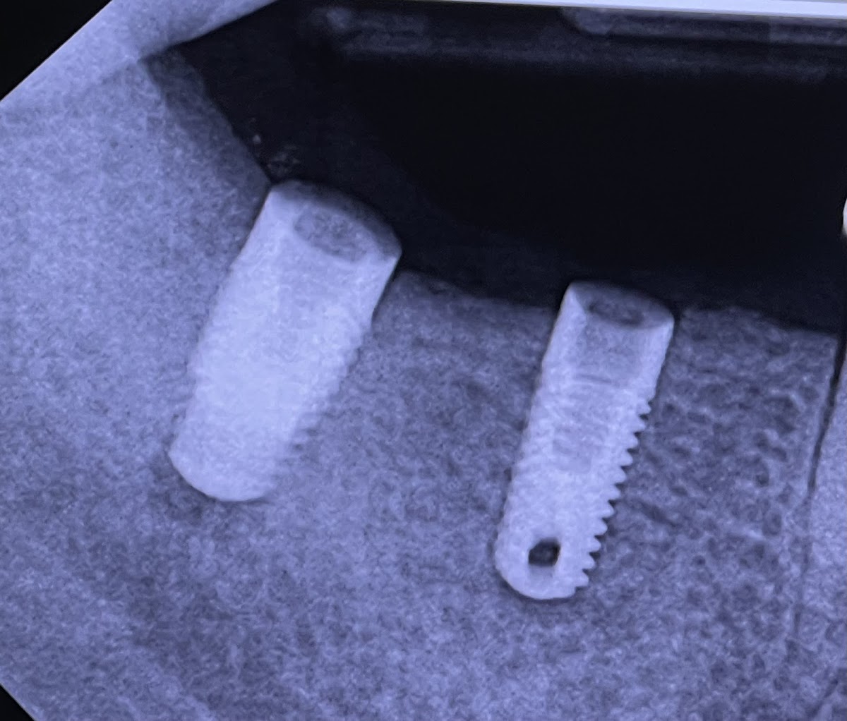 Advanced Periodontics & Dental Implants photo 4