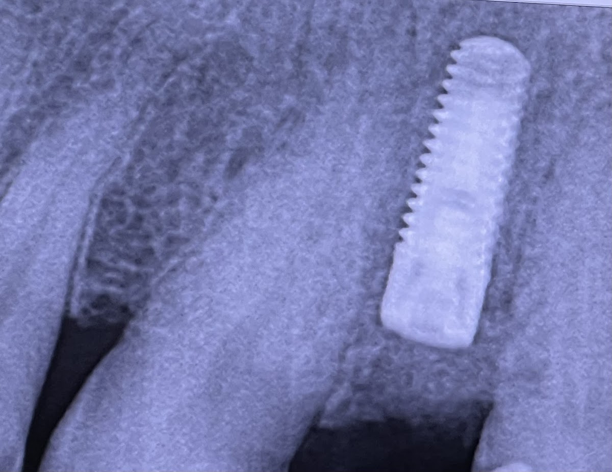 Advanced Periodontics & Dental Implants photo 5
