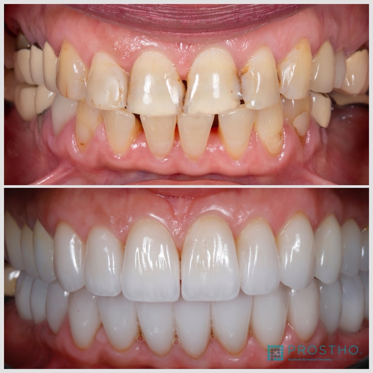 Prostho Endo Dental Group Cosmetic & Implant Dentistry at Bethesda-rockville photo 2