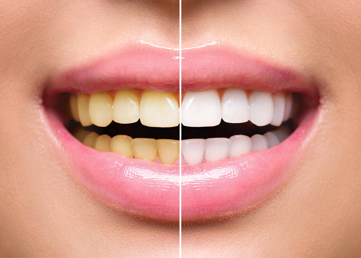 Houston Dental Columbus: Andrew Houston, DMD photo 6