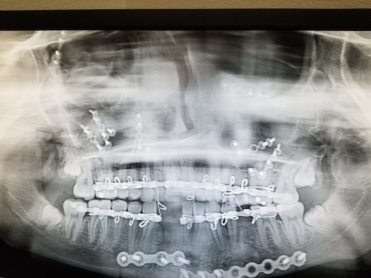 St. Petersburg Oral Surgery & Dental Implants photo 6